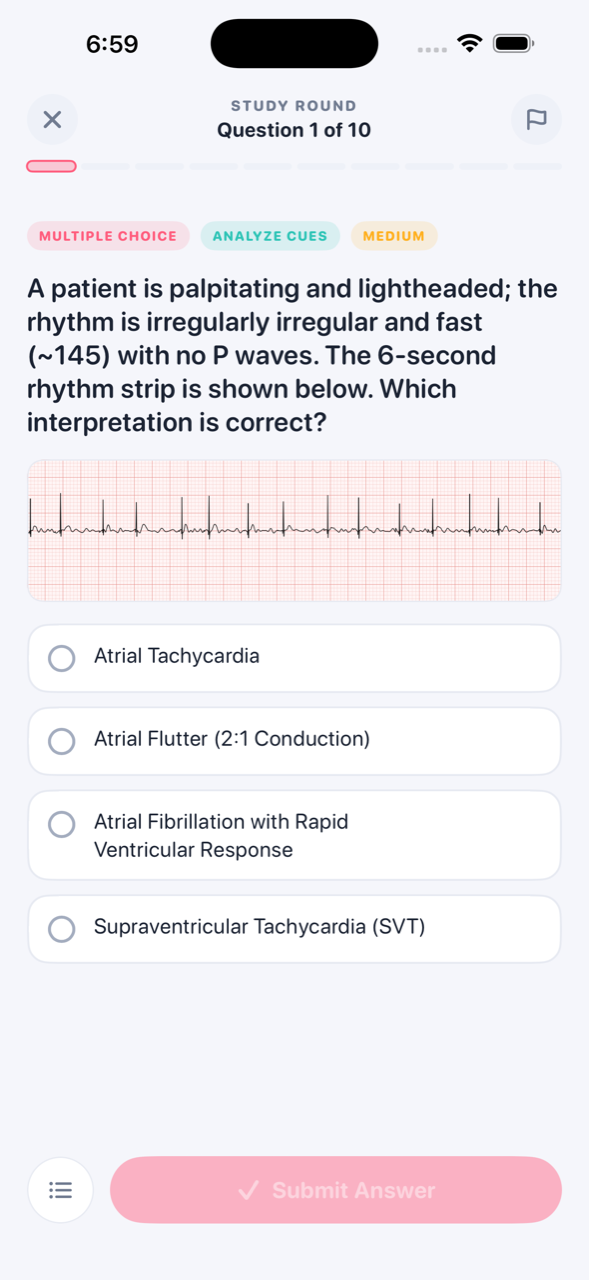 A board-style practice question with an ECG rhythm strip